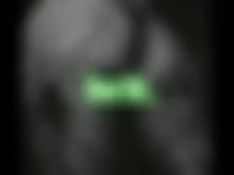 แชท XXX สดของ dakota_krall__