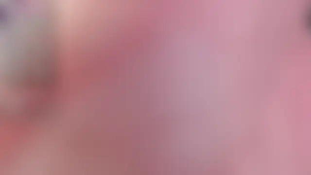 Chat +18 de tingting-youu ao vivo