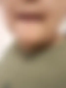 Miss_balloonsmila 라이브 XXX 채팅