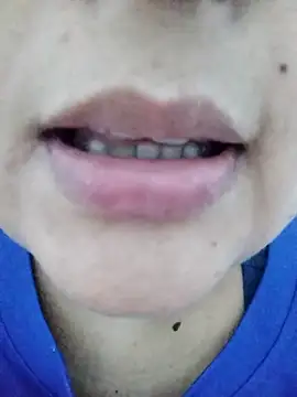Chat +18 de Miss_balloonsmila ao vivo