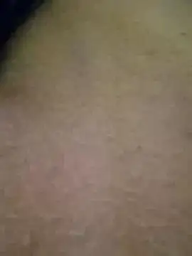 molymeneses – live chatrum