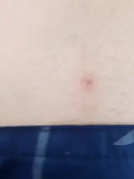 Show de rober079 na webcam