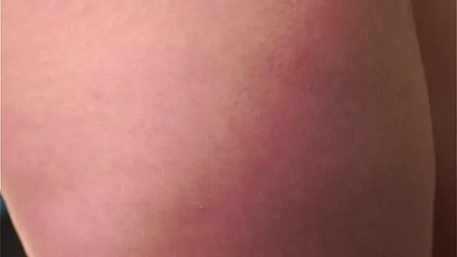 Czat XXX na żywo – AftonChappel