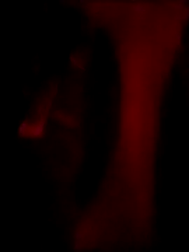 Show de webcam de degeneradicto