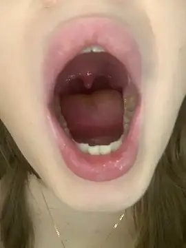 عرض كام T1_ma_2