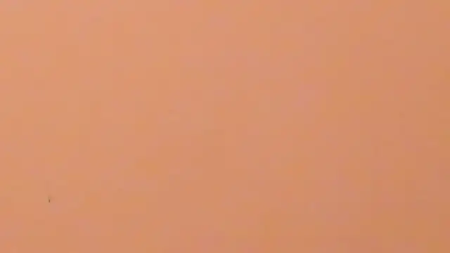 b3cky_: απευθείας συνομιλία ΧΧΧ