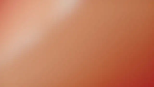 Chat XXX en directo de Myassistant