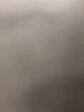 ThyroidLancers Webcam Show