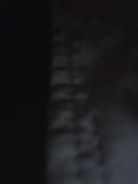 Webkamerová show U_prolazu