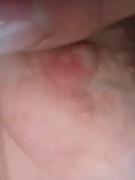 ludderlotta – Live XXX-chat
