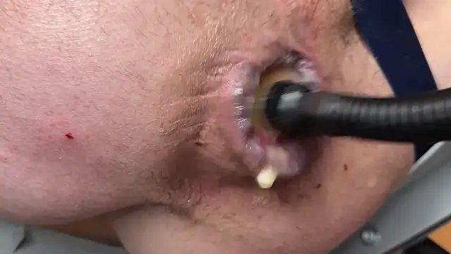 JacsHole's Webcam Show