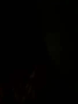 ThyroidLancers webcam show