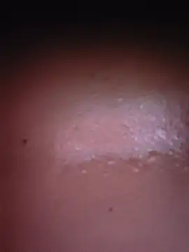 Dicky2212 라이브 XXX 채팅