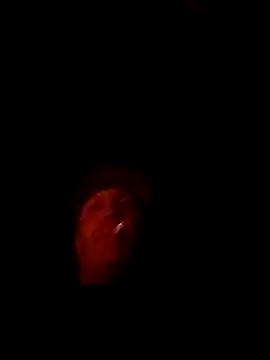 AceticPinscher Show in webcam