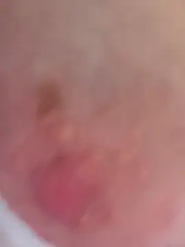 ludderlotta Chat XXX live