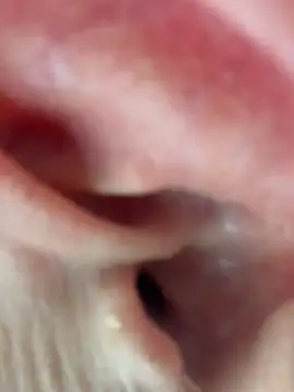 Frosl 现场XXX聊天