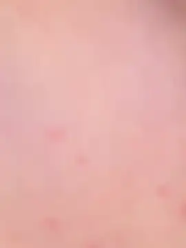 hotbeurette 现场XXX聊天