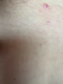 AnneKane লাইভ XXX চ্যাট