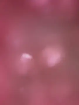 Živý XXX chat MelanieHillss