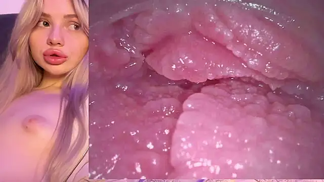 Jannemary - Show cervix