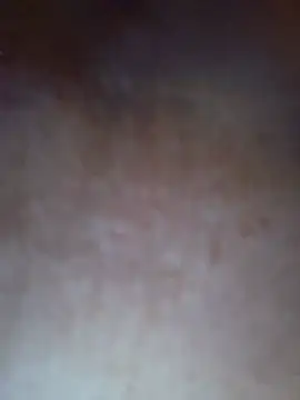SkyelarSomer Webcam show