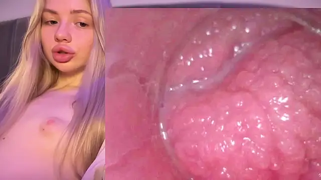 Jannemary - Show cervix
