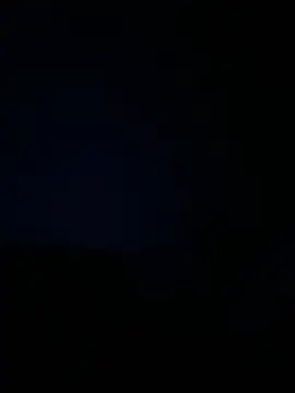 XXX chat uživo modela Frosl