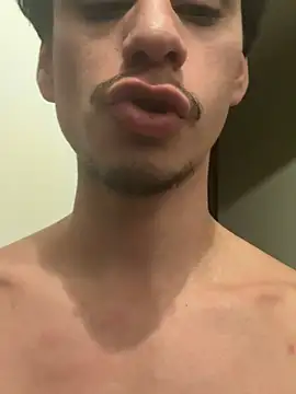 הופעת וובקאם של NaelKald