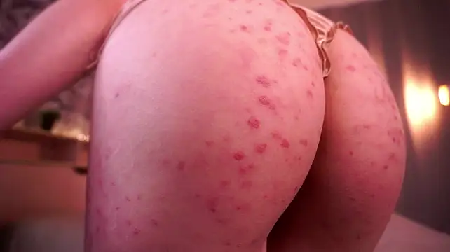 ErlineDennisn Live XXX chat