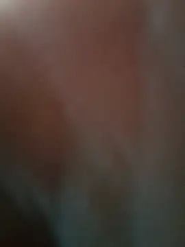 Show de webcam de DrewZoonosis